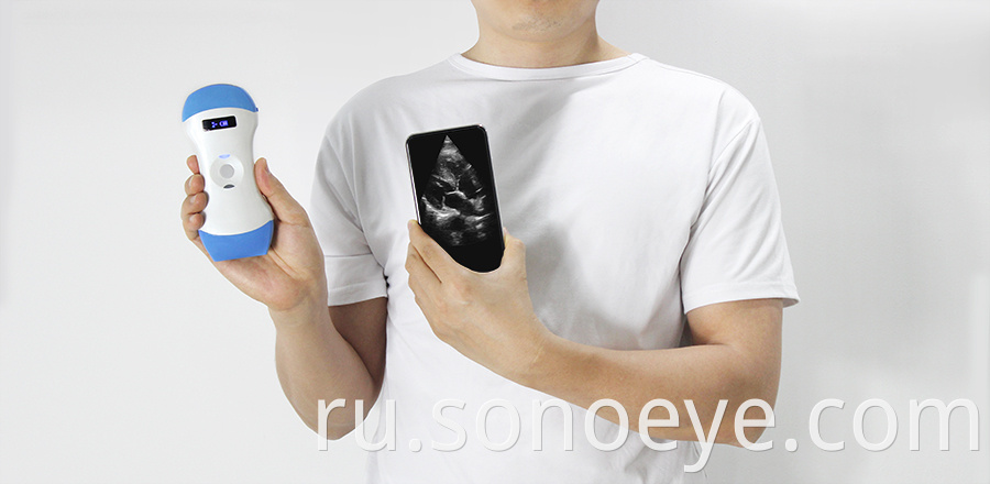 mini ultrasound